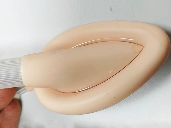 喉罩外部（bù）粘接