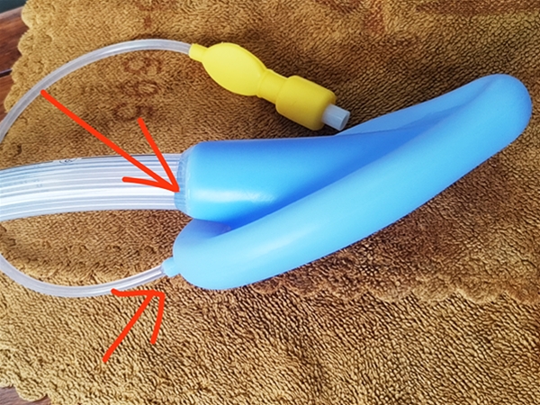 喉罩與矽（guī）膠管（guǎn）接頭粘接